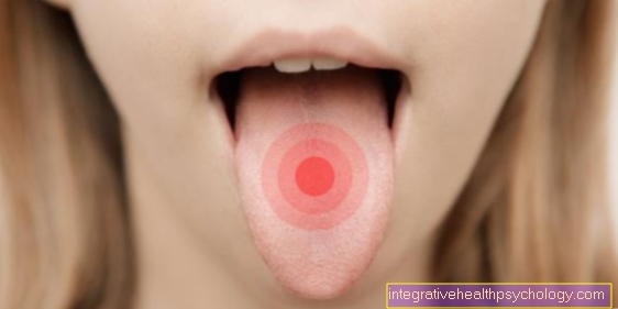 Smerter i tungen