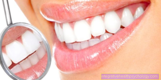 Enfoques terapéuticos para rechinar los dientes.