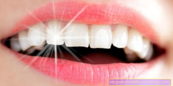 Λευκά δόντια από λεύκανση