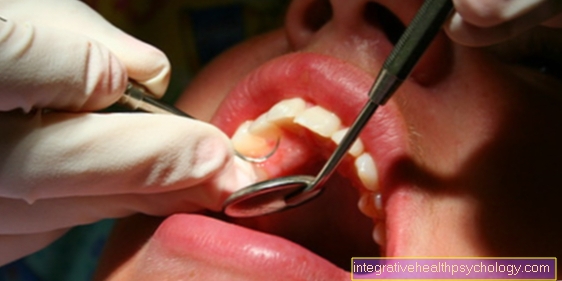 Kuinka tarttuva on periodontaalinen sairaus?