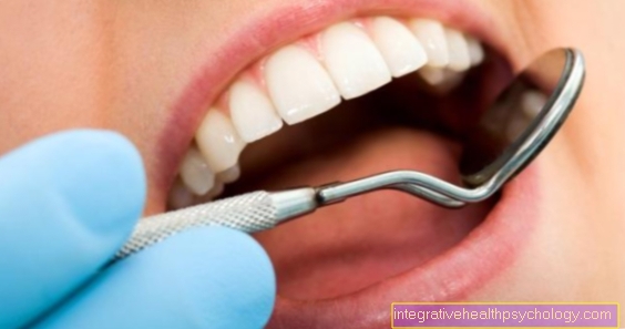 Haavan paranemishäiriö hampaassa