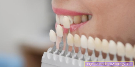 Otturazione dei denti: quali materiali ci sono?
