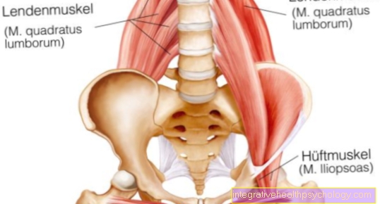 PSOAS Minor мышца